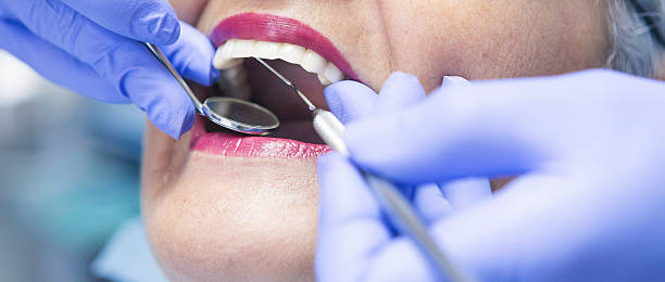Best Emergency Treatment for Toothache in Oran, MO